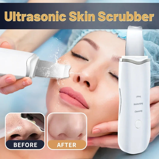 Professional No Ultrasonic Facial Skin Scrubber Ion Deep Face Cleaning Peeling Rechargeable Skin Care Device Beauty Instrument