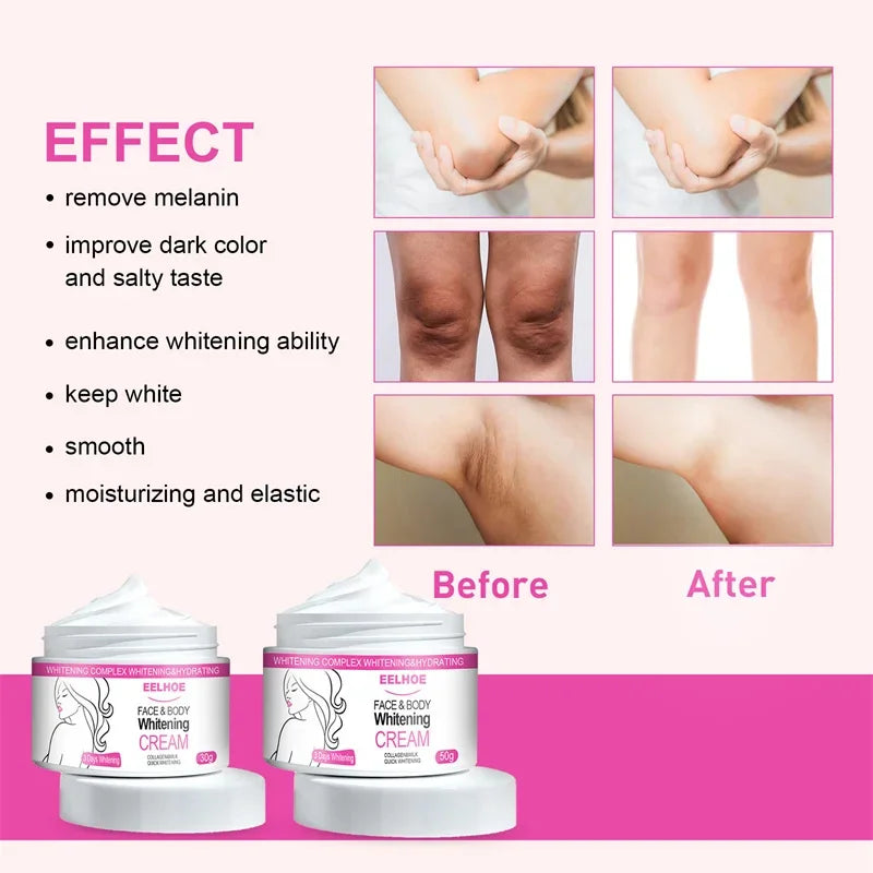 Brightening Cream For Intimate Parts Body Knees Remove Dull Pigments Brighten Serum Elbows Knuckles Lightening Skin Care Product