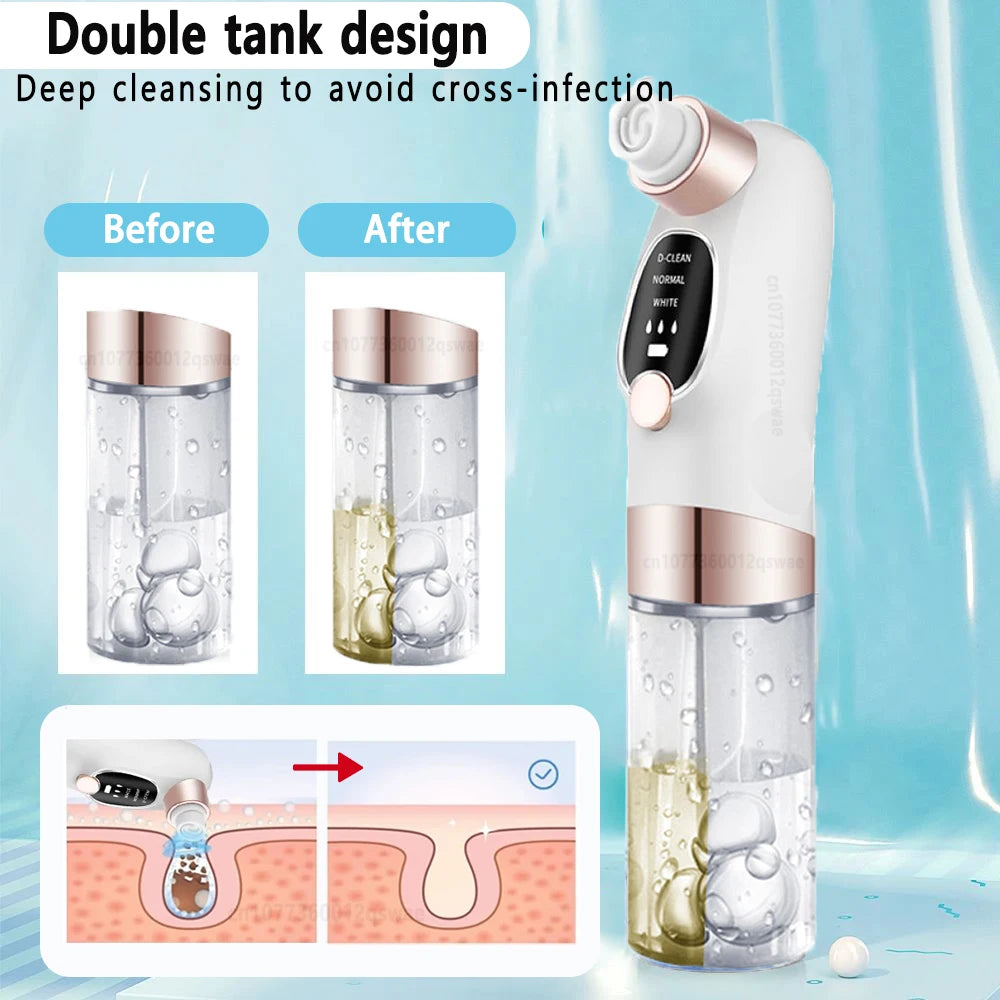 Blackhead Remover Pore Vacuum Face Cleaner Electric Pimple Acne Black Head Removal USB Rechargeable Water Cycle Black Dot Remove