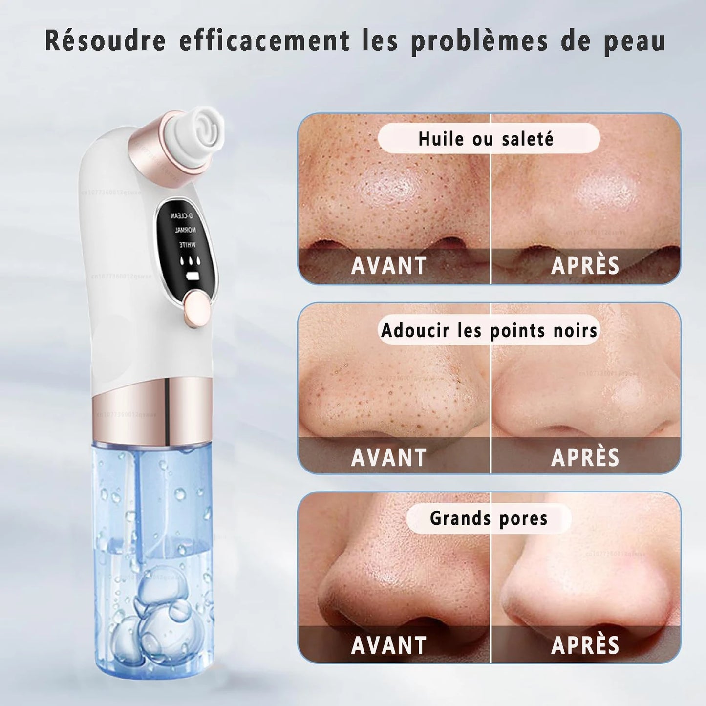 Blackhead Remover Pore Vacuum Face Cleaner Electric Pimple Acne Black Head Removal USB Rechargeable Water Cycle Black Dot Remove